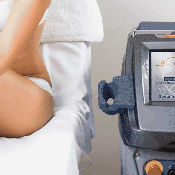 Epilare laser DEKA