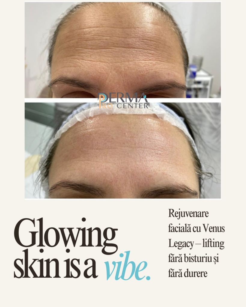 rejuvenare faciala promotie