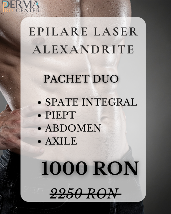 epilare laser deka alexandrite