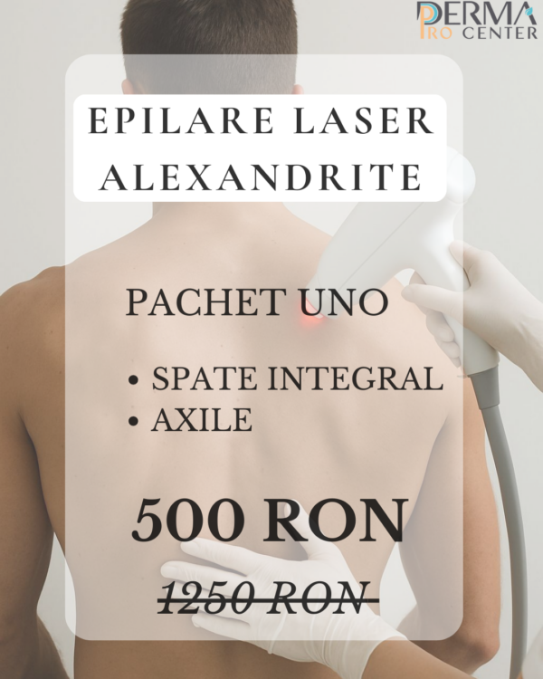 epilare laser deka alexandrite