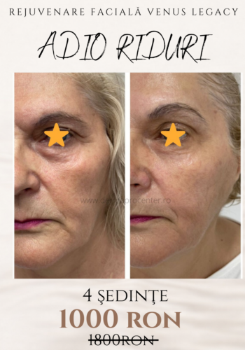 discount abonamente (1)