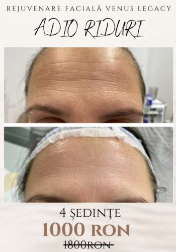 discount abonamente (10)