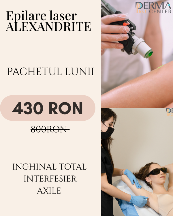 EPILARE LASER FARA DURERE