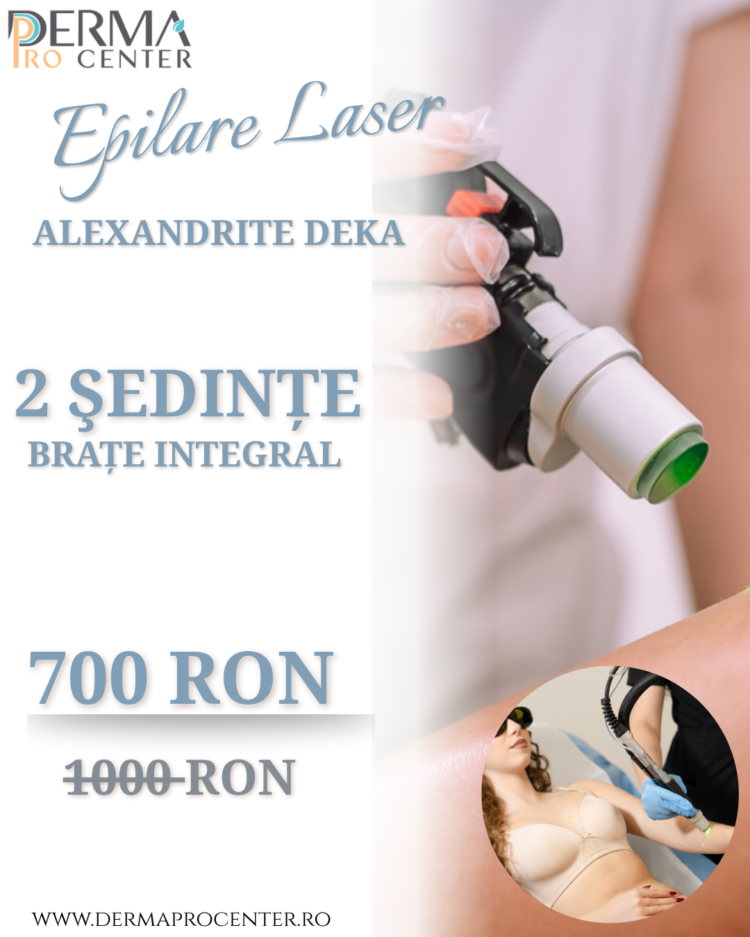epilare laser alexandrite