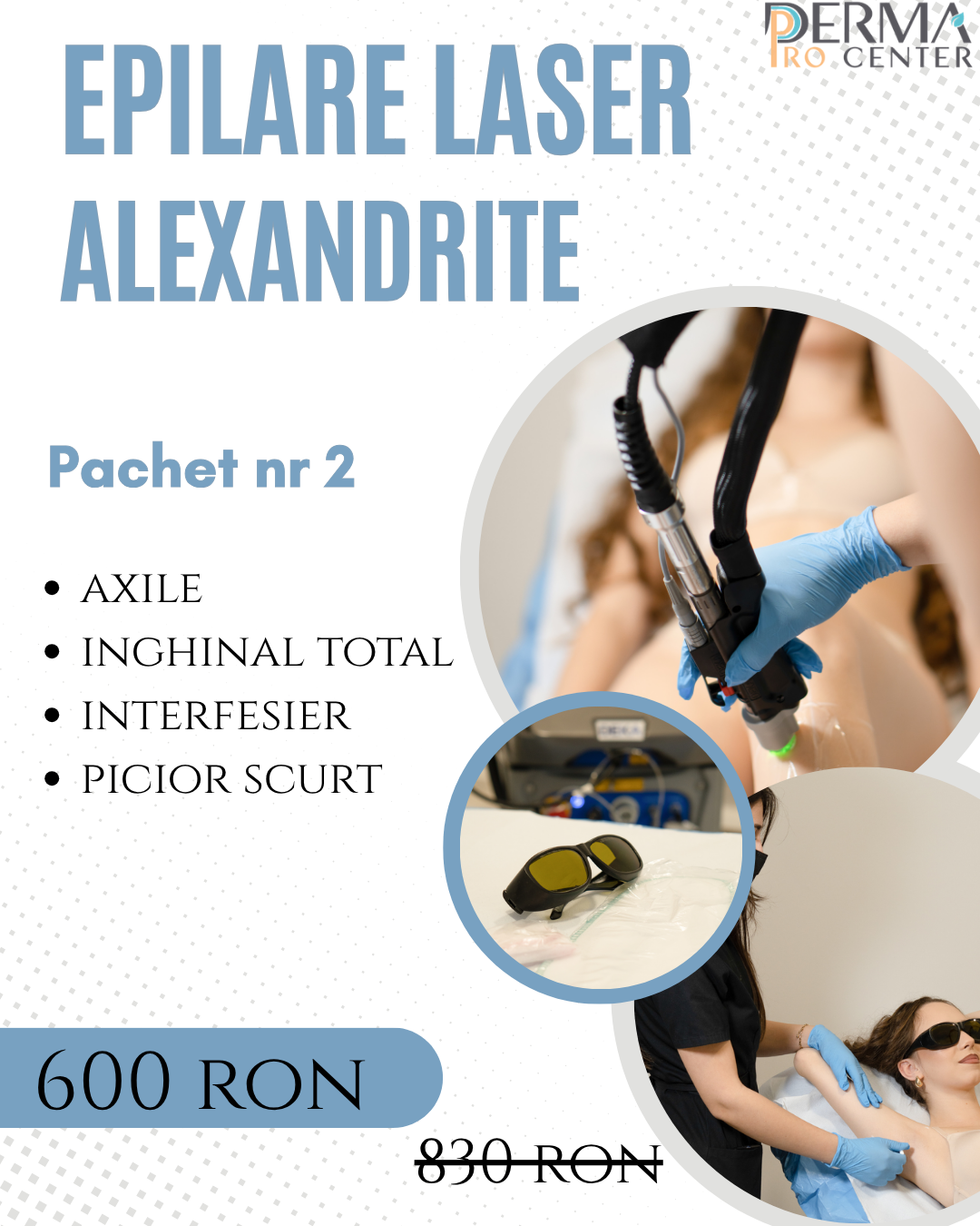 epilare laser alexandrite