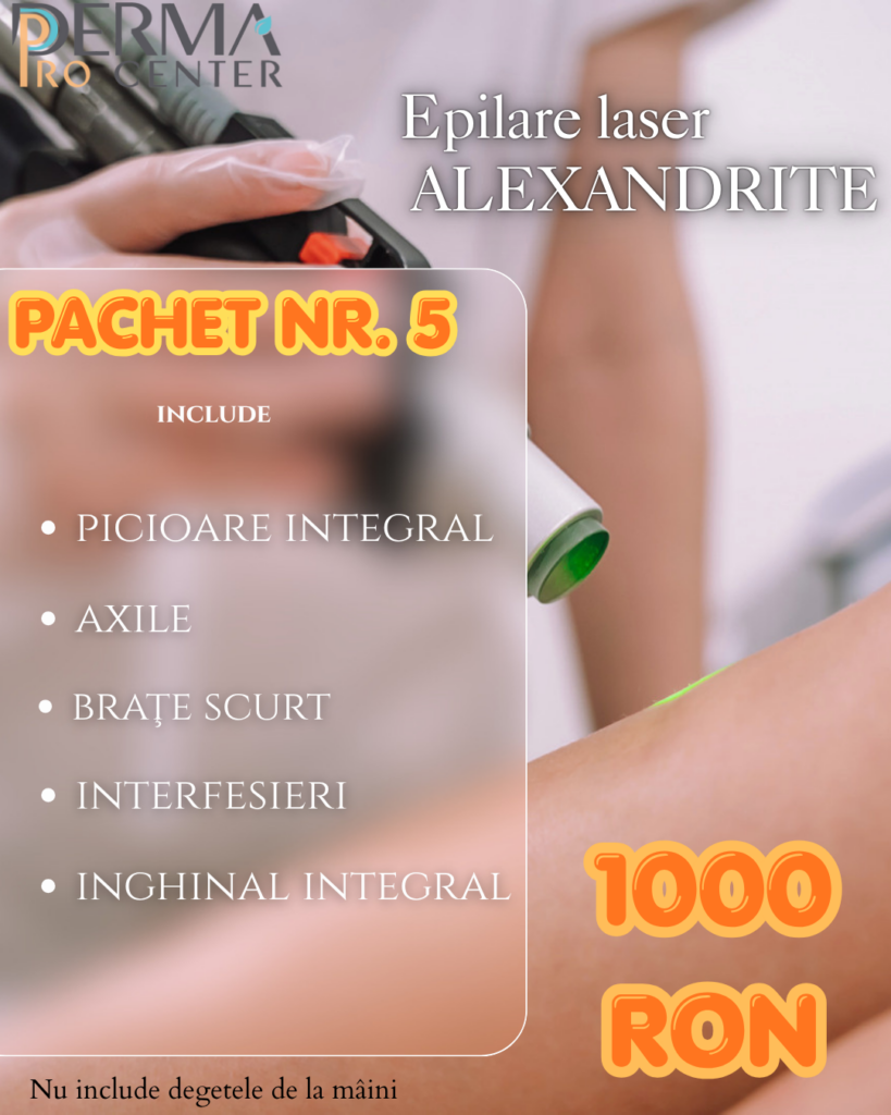 epilare laser alexandrite