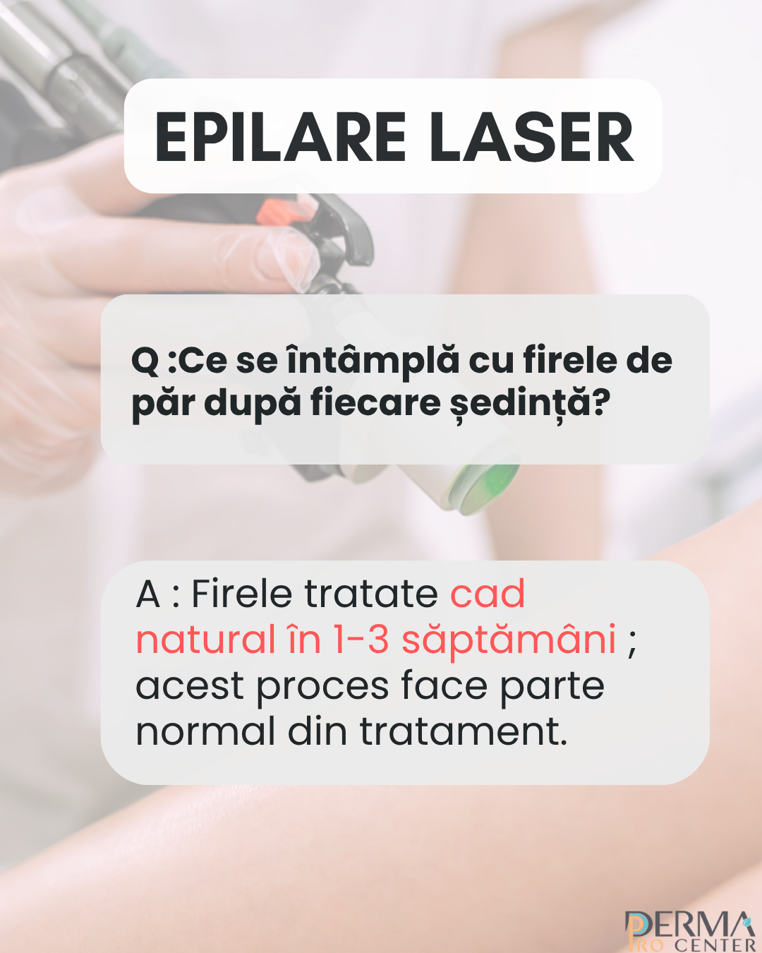 epilare definitiva