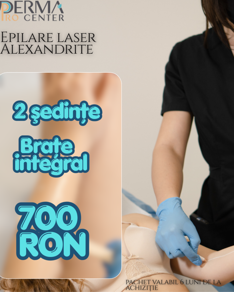 epilare laser alexandrite