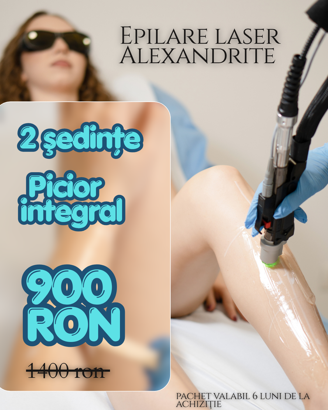 epilare laser alexandrite